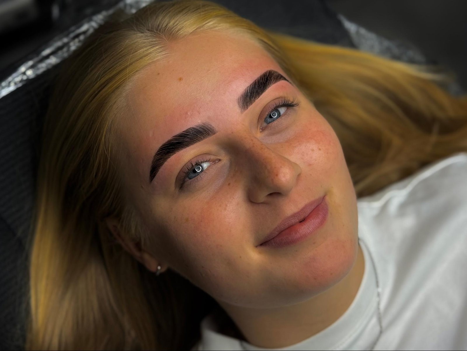 Brow lift resultaat 2