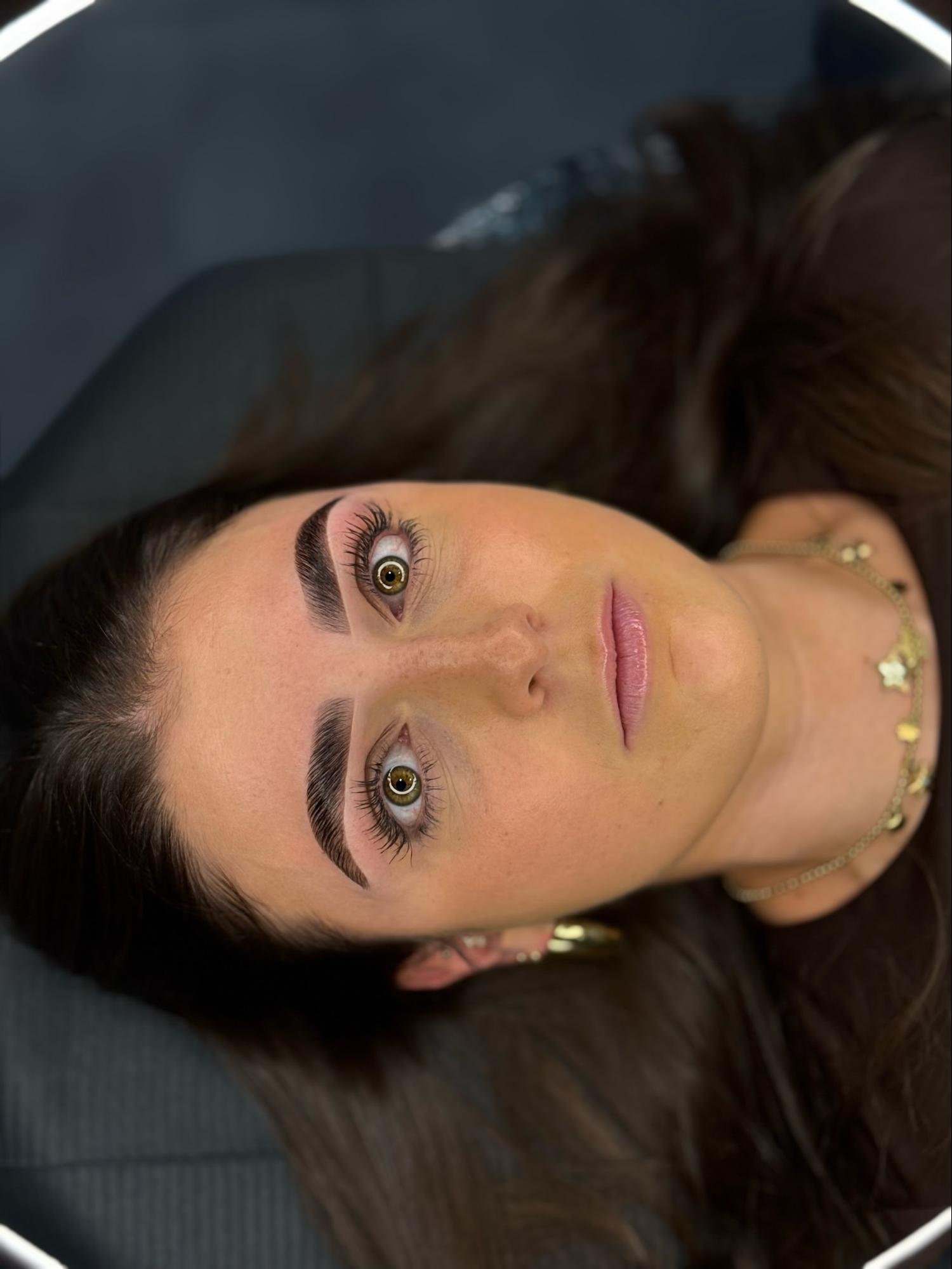 Brow lift resultaat staand