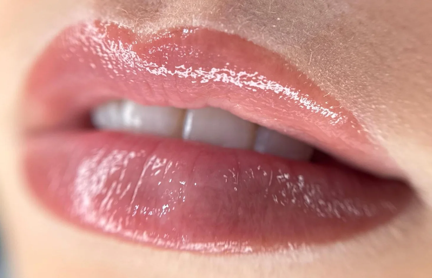 Lip Blush genezen resultaat liggend